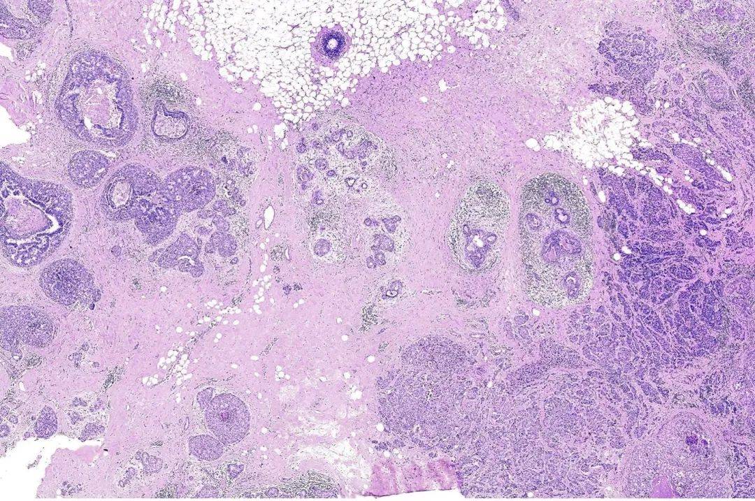 苹果13beta版:10x Genomics公司Xenium原位分析技术助力发现罕见的癌症生物学特征-第3张图片-太平洋在线下载