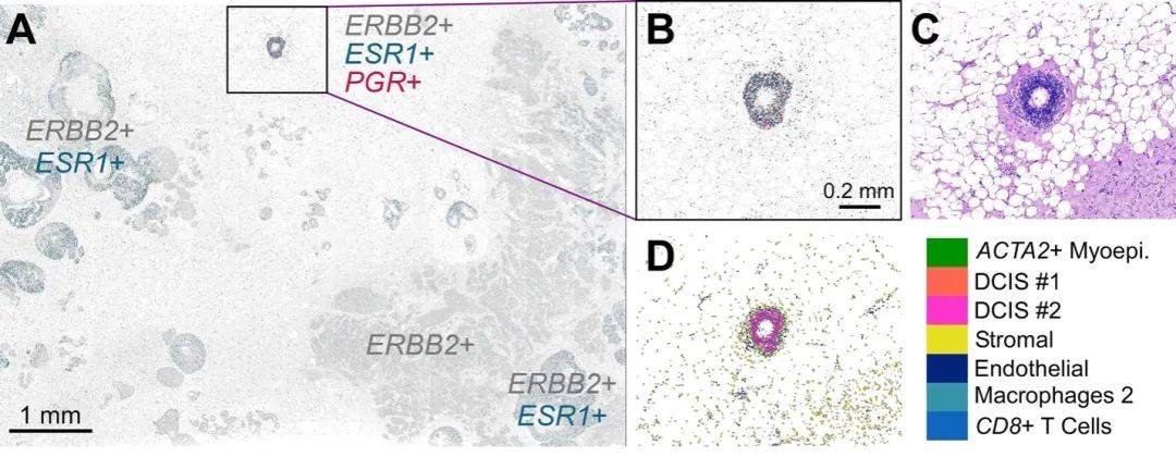 苹果13beta版:10x Genomics公司Xenium原位分析技术助力发现罕见的癌症生物学特征-第4张图片-太平洋在线下载