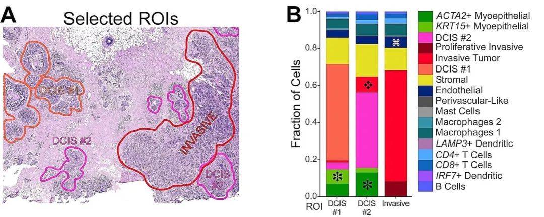 苹果13beta版:10x Genomics公司Xenium原位分析技术助力发现罕见的癌症生物学特征-第5张图片-太平洋在线下载