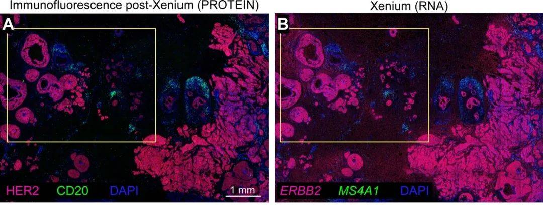 苹果13beta版:10x Genomics公司Xenium原位分析技术助力发现罕见的癌症生物学特征-第6张图片-太平洋在线下载